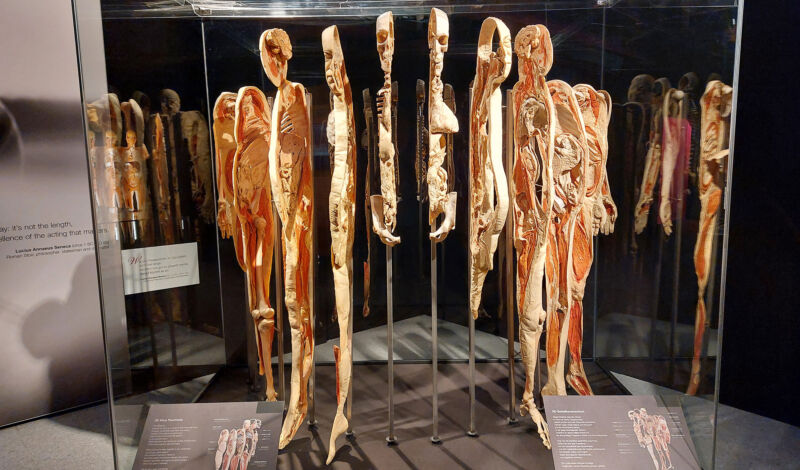 Plastinat eines Menschlichen Körpers in der Ausstellung Körperwelten